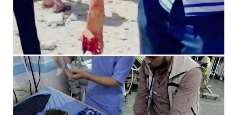 مجزرة جديدة للعدوان الأسدي الروسي في أريحا و11 شهيد و27 جريح