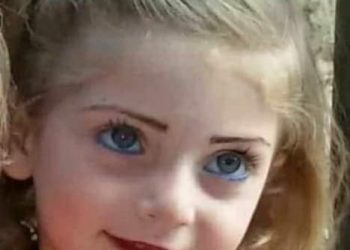 من حرق الخدين من؟!