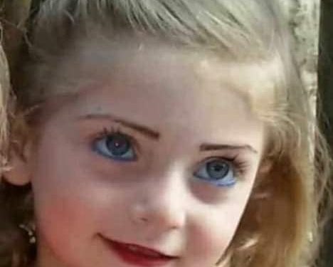 من حرق الخدين من؟!