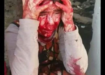 إدلب وحالة التخلي (المُعَولَم)