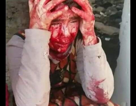 إدلب وحالة التخلي (المُعَولَم)