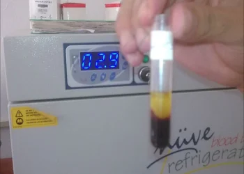 التهاب الكبد الفيروسي يجتاح سورية في مواجهة نظام صحّي مهترئ