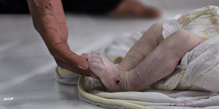 “بائعة الكبريت” في غزّة